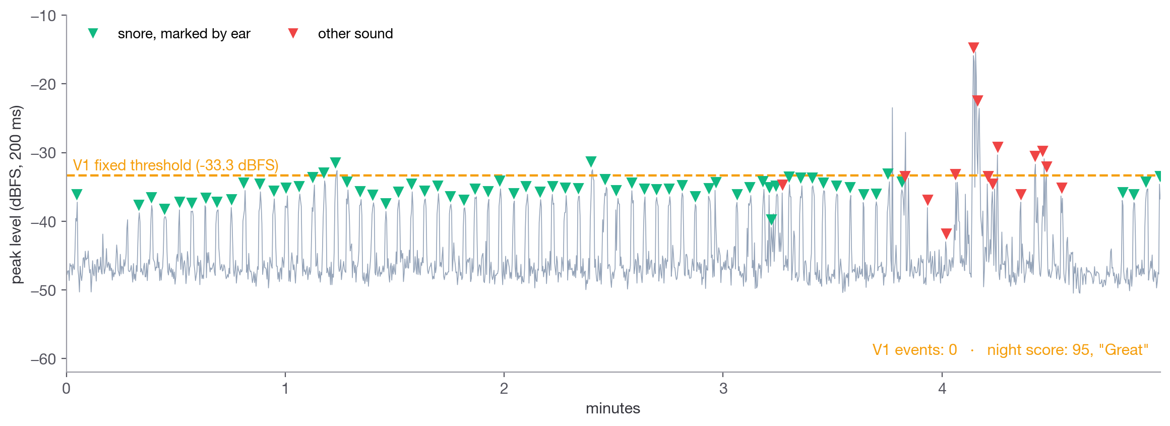 Five minutes of a real night with V1's fixed threshold as a dashed line: 67 snores marked by ear sit around or below it, a few peaks cross it briefly, and V1 records no event